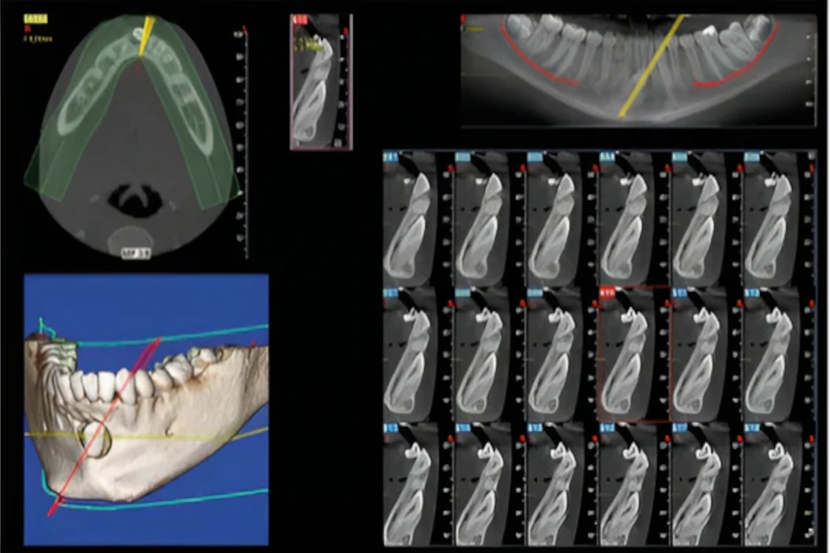 CBCT Image