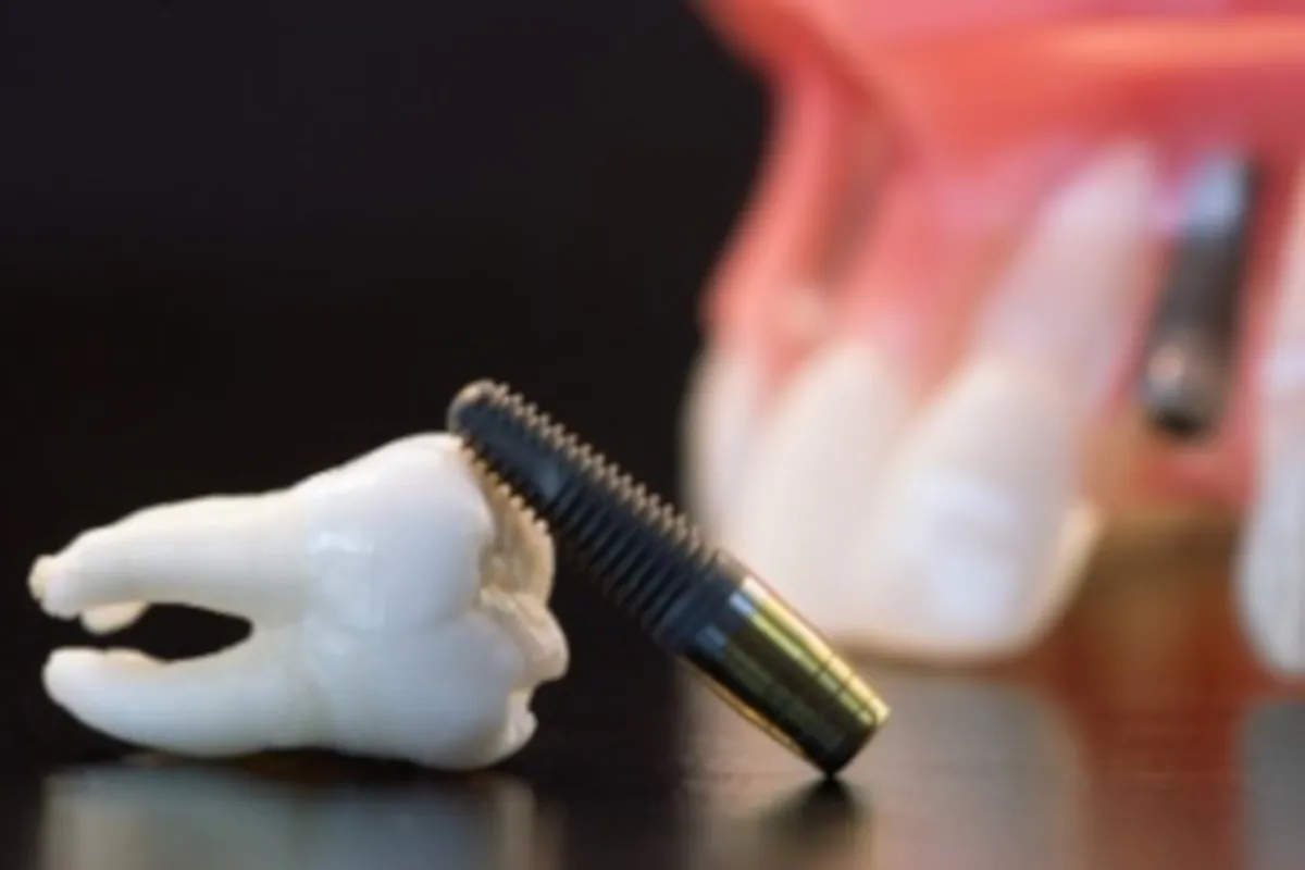 Dental implants pain blog image